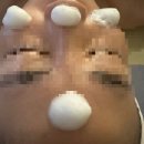 벤자롱 SPA | [광주 피부관리] 북구 용봉동 에스떼젠에서 아로마 마사지 후기