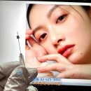 마리오넷 주름 심술보 제거 후기 좋은 수아연한의원 시술만의 특징 2가지
