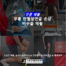 스프린트 PT | 대연동 PT 무릎 재활 후기 - 무릎 반월상연골 손상 후 재활 사례