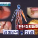 염증 위험 낮추는 식단은? 이미지