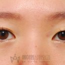 에이엠성형외과의원 네이버블로그