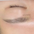 아인뷰티의원 이미지