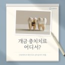 문현치과의원 | 개금 충치치료 후기 | 신세계치과 레진치료 실제 사례