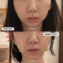 청주 얼굴경락 효과좋은 아름하다 만족후기(웨딩관리)