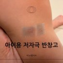 이노싸이트 | 이노테이프 실리콘테이프 아이용 반창고 사용 후기