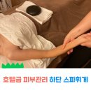 스파휘게 하단점