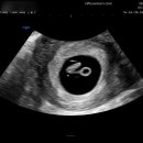 에펠산부인과의원 이미지