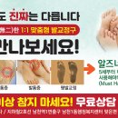 1:1 맞춤형 발교정구 ＜알즈너＞ 환희대리점 이미지