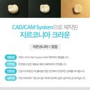 중앙치과기공소 네이버블로그