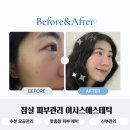 [잠실 피부관리] 이시스에스테틱에서 받은 수분 모공 관리 추천 후기