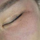 라헨느 | 둔산동 피부관리 기미 모공 트러블 여드름 흉터 트라이엄 관리 라헨느뷰티 솔직후기