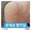 경기도 수원시 영통구 영통로 | 수원 영통 발각질, 장화착용으로 심해진 발각질 관리 후기