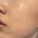 에스테틱 약초필링 원데이필 셀프로 한 후기 (2) - 과정 전 후 사진