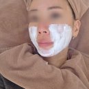 심은솜씨 2 3공장 | 울쎄라300샷가격 효과 및 통증, 붓기 내돈내산 후기