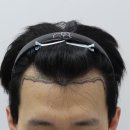 압구정맘모스헤어라인의원 이미지