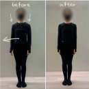 SNPE 바른자세 척추운동&목·어깨 통증테라피 | SNPE 운동 리얼체험기｜동탄SNPE 솔직후기, 자세교정 비포애프터