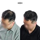 모멘즈