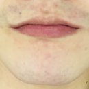 송준호레이메디의원 이미지