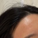 브로우돌 | 브로우돌 이마왁싱 후기 | 이마 잔털 정리했을 뿐인데 인상 달라짐