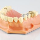 우리치과기공소 이미지