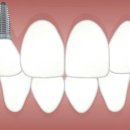 서울미인치과의원 이미지