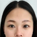 누브의원 이미지