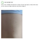 백식 주작용이 이건가요 ?? 산화그라핀 이라고해야 하나?? 팔각정처럼 생긴 거미형태가 문양이 나타남 이미지