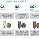 오스템임플란트 종류 등급, 뭐가 다른지 한번에 정리 이미지