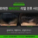 모아만의원 네이버블로그