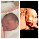 나은병원 본관(1) | 임당산모 선택제왕출산 / 38주 제왕절개 출산 찐후기 / 병원본관 1인실B 입원후기(4박 5일 조기 퇴원한 썰)