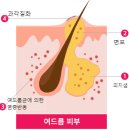 에이인피니