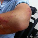 신사멜로우피부과의원 네이버블로그