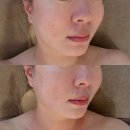 세븐일레븐 울산삼산문화점 | 울산 삼산 피부관리 살롱드비숑 윤곽관리 잘하는 에스테틱