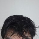 촘촘 스칼프 | 두피가려움 지성두피샴푸 추천 스칼프100 오리진 후기