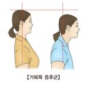 포스트필라테스시화