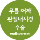 관절내시경 간단한 시술로 치료하는 무릎연골수술 – 반월상연골판파열의 절제술과 봉합술 :)웰튼병원 이미지