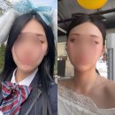 신논현피부과 콜라겐주사 미희주사 2회차 후기 (feat. 앞볼&amp;옆볼 / 한달 경과 후기)