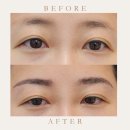 알고뷰티 - 서구 상무화원로12번길 4 | 별내 눈썹 문신 자연스러운 디자인 만족스러웠던 에버뷰티 후기