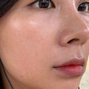 피부가죤사람들 | [청담동피부과] 울트라클리어+고우리 효과, 통증, 울리고패키지 가격