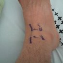 저의 증상에 대해서 질문 드립니다... 이미지