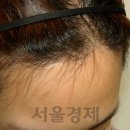 옥건헤어라인의원