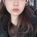 엘클래식의원 | 에버글로리의원 : 엘윤곽주사와 슈링크리프팅 솔직후기 , 윤곽주사 비포애프터