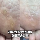 레푸스대전둔산점&더예쁜손발톱
