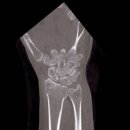 강매로 | 강매역 정형외과 치료 잘하는 곳 특징?