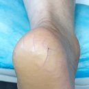 레푸스 앤 쓰담네일 이미지