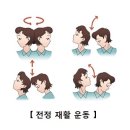 전정신경절단술 이미지