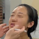 민가한의원 | 10분 양악시술 (한의원 야매랑 비교 노노 ^^)