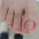 대전레푸스다솜네일 이미지