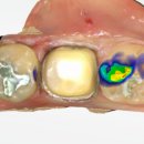 애플치과기공소 이미지
