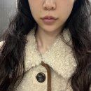 광명상사 | 30대 팔자주름 송도피부과에서 올리디아로 효과 본 후기(별로 안 아픔)